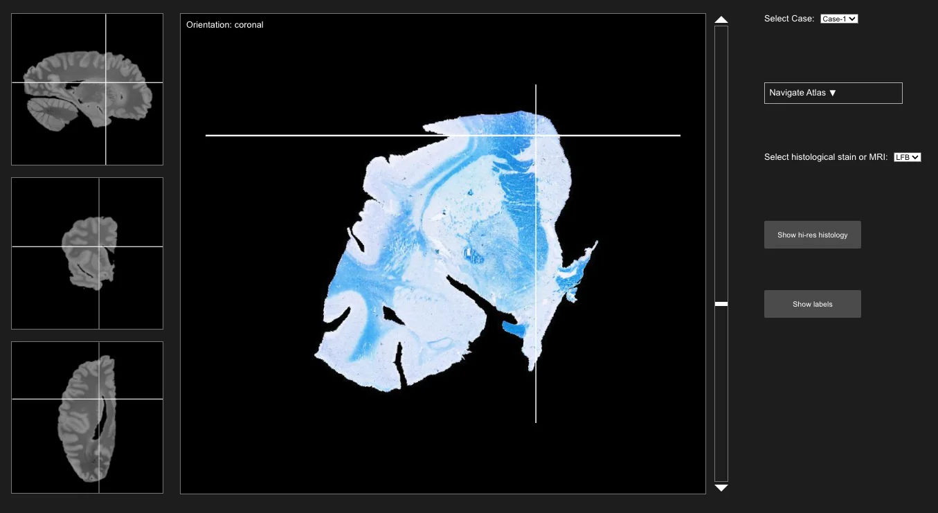 NextBrain